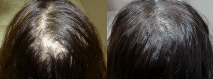 Anti Hair Loss Growth Serum – Restore, Strengthen & Regrow Naturally